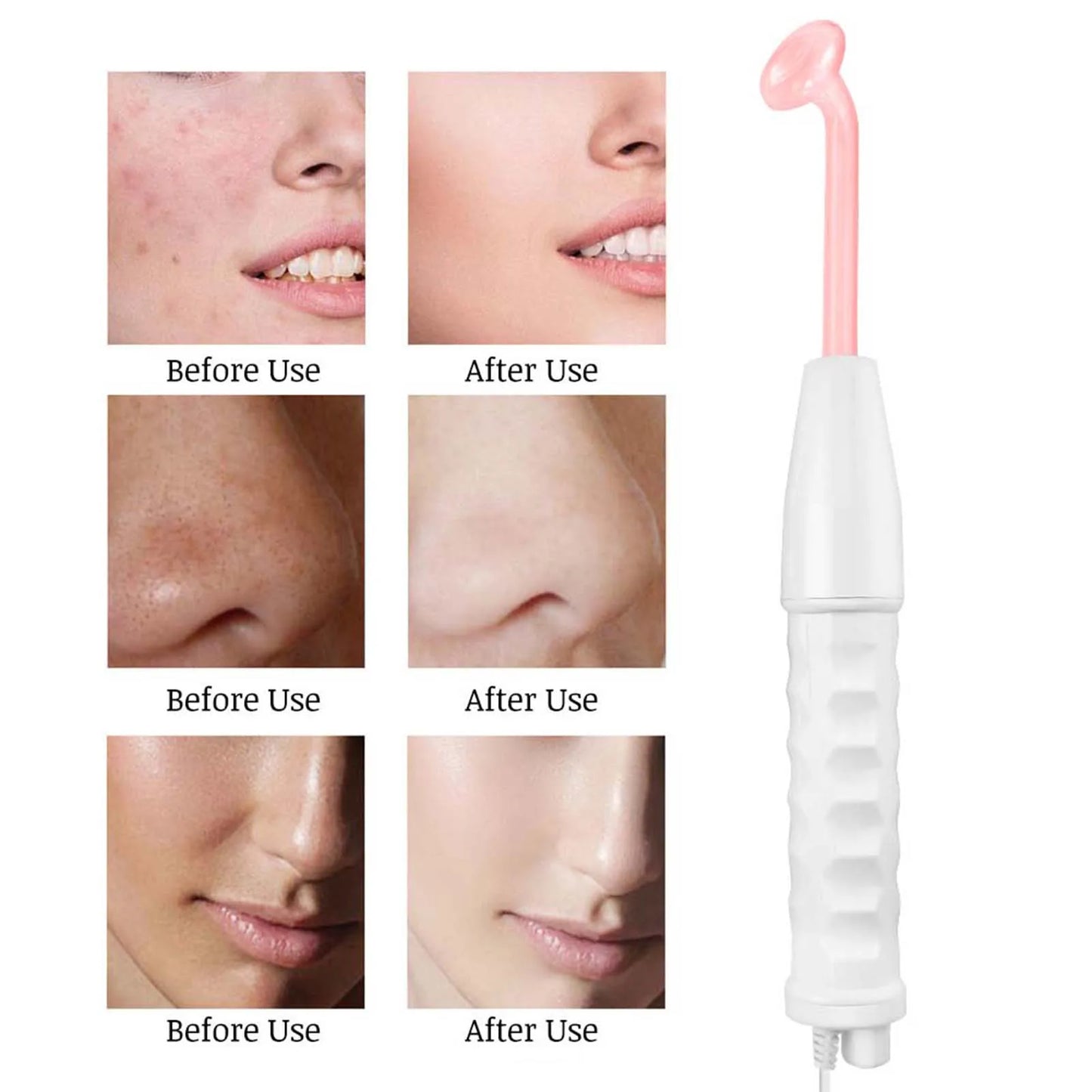 Facial Machine for Skin Tightening – High Frequency Electrode System for Face & Body Care, Wrinkle Removal